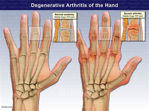 Joints Of Fingers