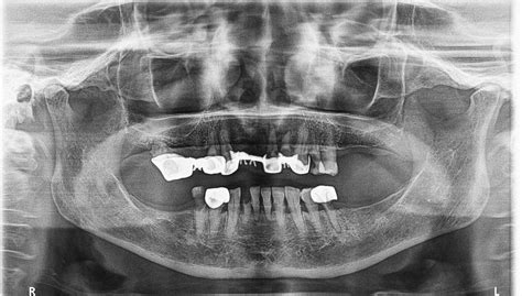Importancia De Los Informes Radiográficos En La Práctica Dental General