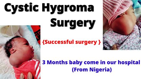 Cystic Hygroma Surgery In 3months Baby Mrrm Hospital Youtube