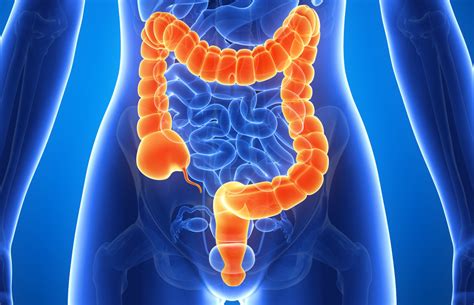 A colon can also introduce something that acts as an appositive. Colon Cancer Diagnosed 10 Months After Start of Symptoms ...