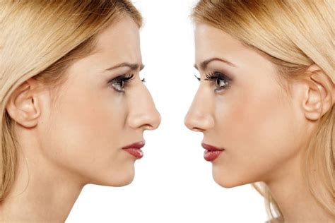When Can The Patient Undergo Reconstructive Plastic Surgery Xpose