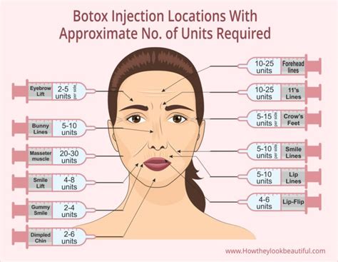 Where On Your Face Can You Get Botox Injected With Units