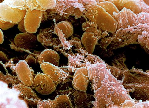 Plague Bacteria Photograph By Niaidcdcscience Photo Library Pixels