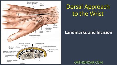 Dorsal Approach To The Wrist 2023 Orthofixar