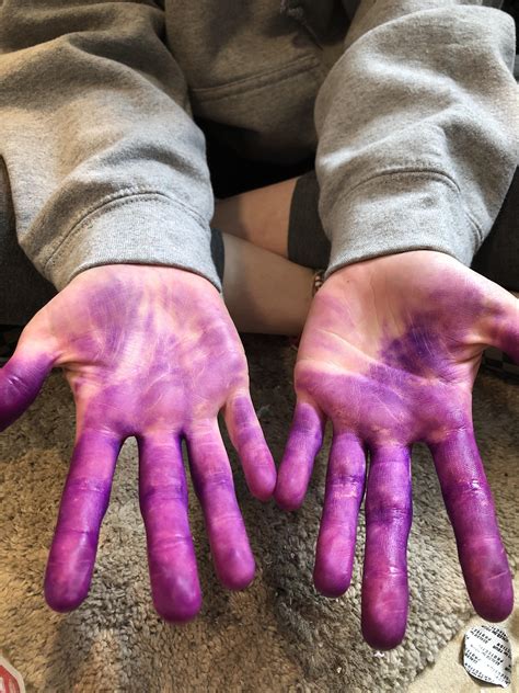So My Friend Has Purple Hands She Used Splat Hair Dye And It Stained