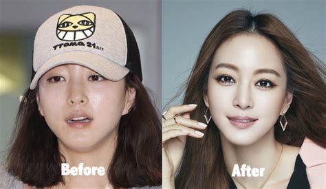 Han Ye Seul Surgery Hot Sex Picture