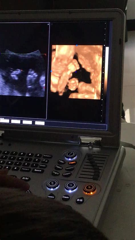 Dw L5dw C60plus Ultrasound Pregnant 4dandultrasound Diagnostic Medical