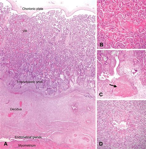 —histology Of The Normal Macaque Placenta A Full Thickness Section