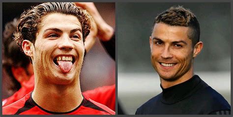 Cristiano Ronaldo Teeth Before And After A Selection Of Photos