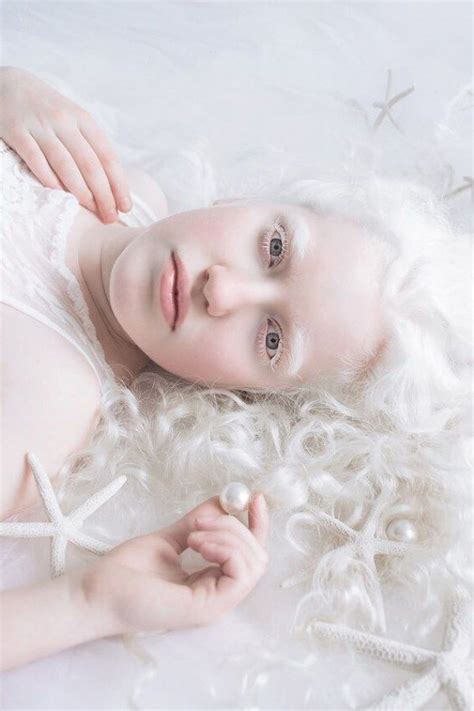 Épinglé Sur Albinos