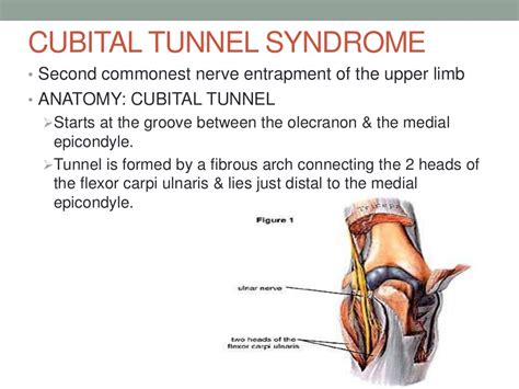 Entrapment Neuropathy Of The Upper Limb