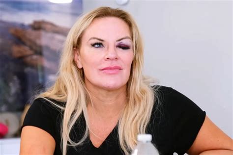Heather Gay Admits Humiliating Truth About RHOSLC Black Eye As Bravo Confirms Investigation
