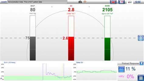 Lidcounity Lidco Hemodynamic Monitoring For The Entire Patient Pathway