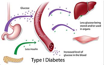 These conditions subsequently lead to the progression of type 2 diabetes mellitus (dm2). Holistic MD Shares Natural Strategies for Insulin ...