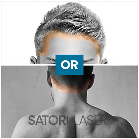 hairline m laser hair removal satori laser