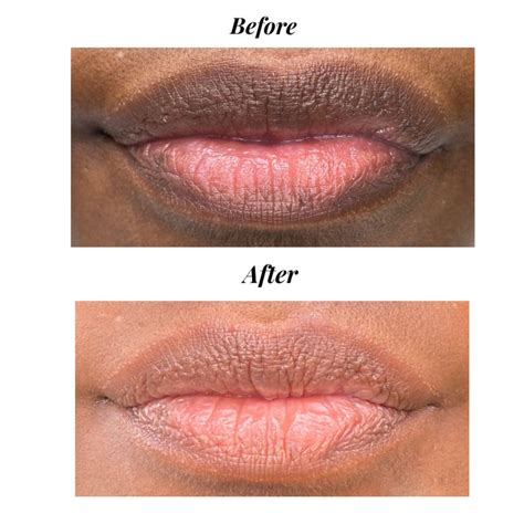 Pmu Dark Lips Correction Editable Digital Dark Lips Etsy