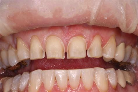 Img5966 Web Lee Ann Brady Dmds Dental Blog