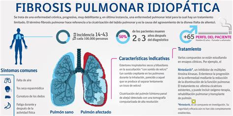 Fibrosis Pulmonar Idiop Tica Una Enfermedad Rara Que Exige Un