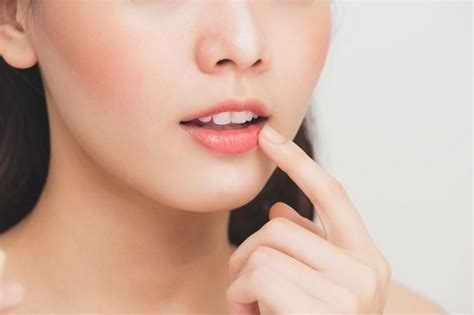 Cara Mengatasi Bibir Kering Agar Kembali Lembap Dan Merona Alodokter