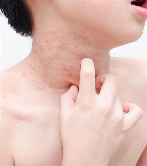 Itchy Rash Treatment Rash On Toddler Skin