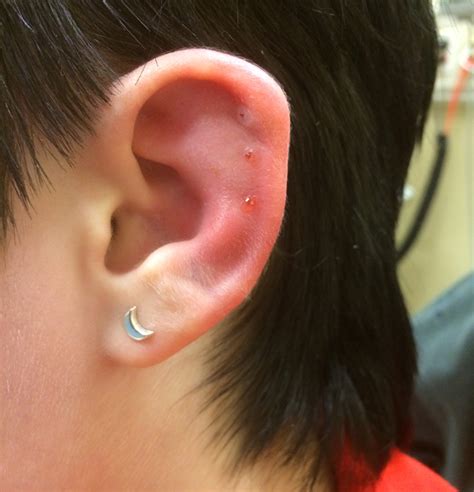 Cartilage Piercing Infection Causes Signs Bump How To Treat Clean
