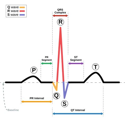 Zespół QRS - QRS complex - other.wiki