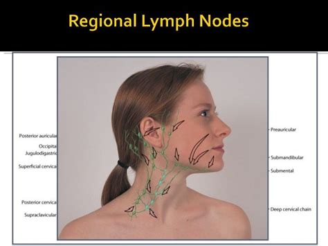 Lymphatic Drainage Of Tongue• In Relation To The Lymph Drainage Of The