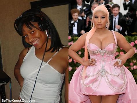 everything you should know about nicki minaj s alleged plastic surgery all the details here