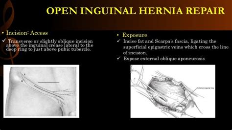 Pathophysiology Of An Inguinal Hernia Carles Pen Images And Photos Finder