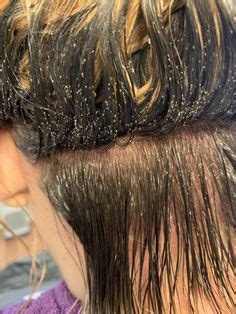 47 HQ Photos What Does Lice Look Like In Blonde Hair ...