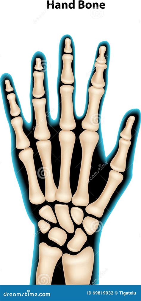 Hand Bone Fracture Distal Radius Fracture And Broken Arm Bone Types