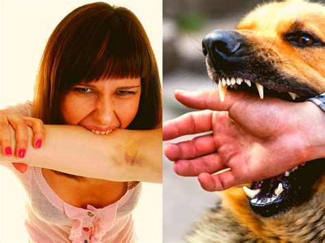 What Are The Dangers Of Dog Bites