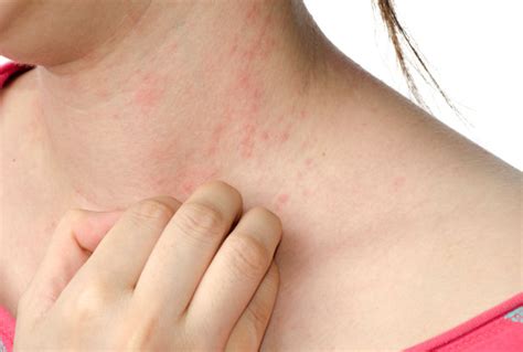 A Rash Not Itchy Why It Happens And What To Do New Health Advisor
