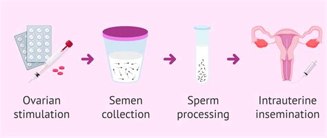 what is intrauterine insemination iui with partner s sperm