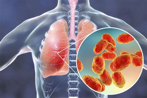 Apa saja gejala gejala orang yang terkena covid 19? Bagaimana COVID-19 Menyerang Organ Vital di Tubuh Manusia?