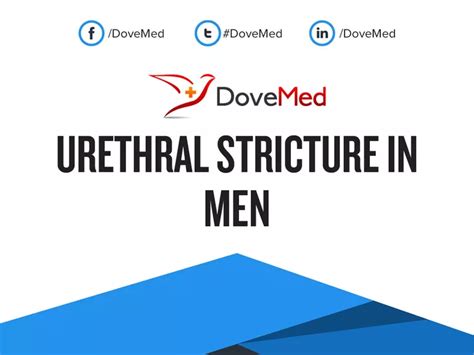 Urethral Stricture In Men Dovemed