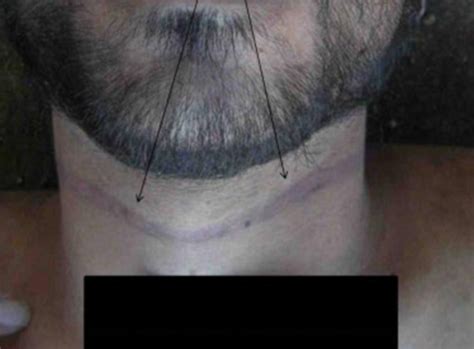 Syrian Regime Torture Photographs Could Be Tip Of Iceberg Human Rights Experts Warn Daily