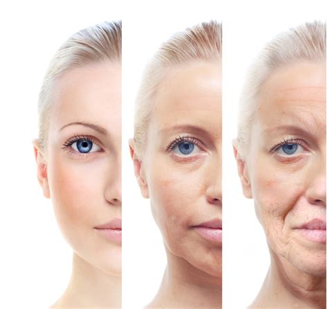 Facial Aging And The Importance Of Volume Refreshed Aesthetic Surgery