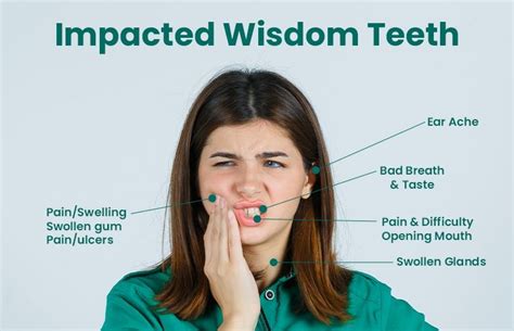 Should You Get Your Wisdom Tooth Removed If Experiencing Aches The