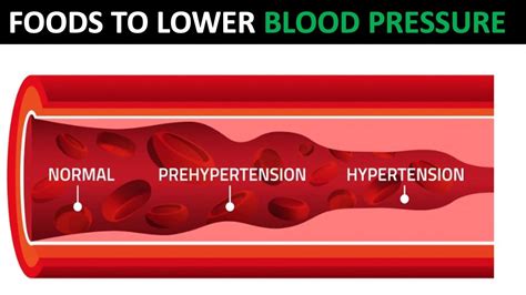 Foods That Lower Blood Pressure Without Medications YouTube