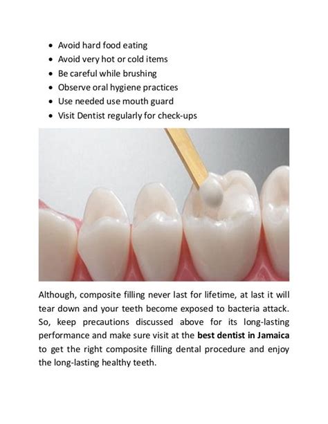 how long composite fillings last and take care of it