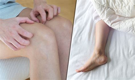 Restless Leg Syndrome Symptoms Condition That Causes Tingling Toes Uk