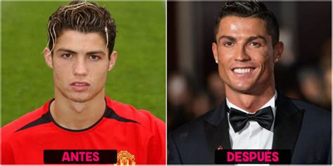Cirugías de Cristiano Ronaldo Antes y después Cirugias de