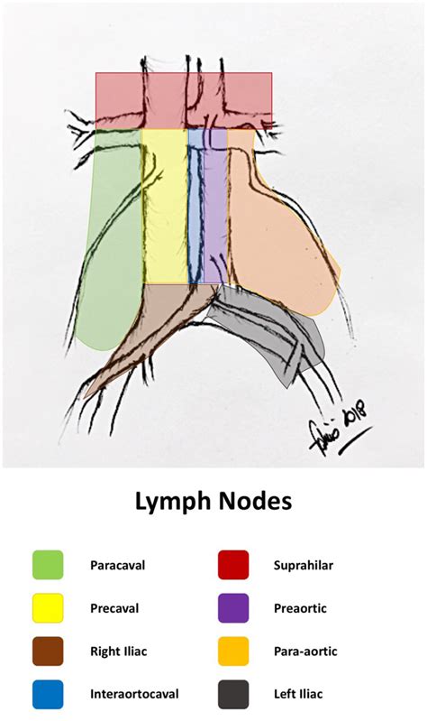 Retroperitoneal Lymph Node Areas Original Drawing By The Author