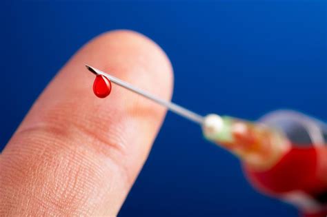 Trainee Doctorsstudents At Most Risk Of Needle Prick Infections