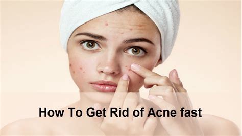 How To Get Rid Of Acne Fast How To Get Rid Of Acne Fast Overnight And