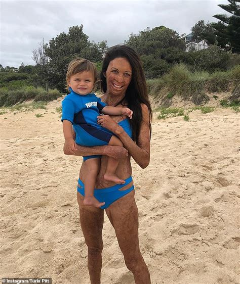 Burns Survivor Turia Pitt Reveals She Has Cut Back On Her Recovery Due To Her Pregnancy Daily