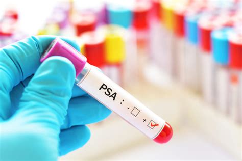 Know About Psa Levels And How To Lower Them