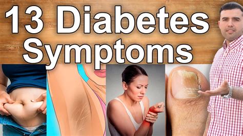 You Have Diabetes If You Have These First Symptoms 13 Symptoms Of