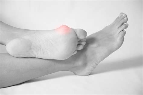 Bunions And Hammertoes Podiatry Of Greater Cleveland